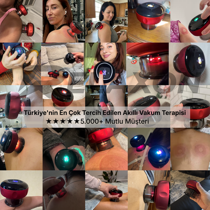 Relaxon Cupper: Yeni Nesil Akıllı Hacamat